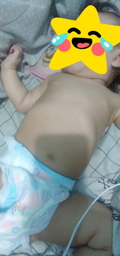 is it normal?