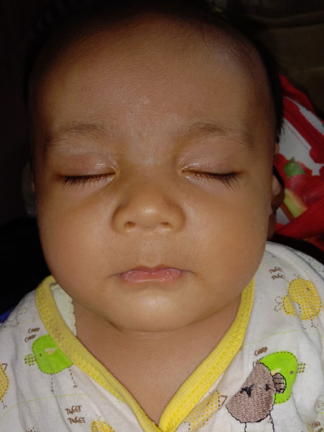 kulit bayi