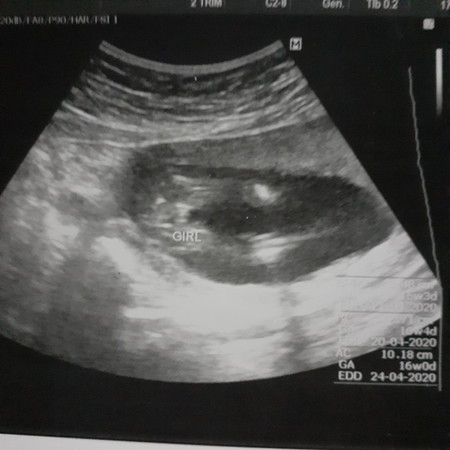 ตื่นเต้น