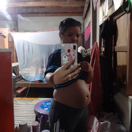 อ้วนหรือท้องออก?