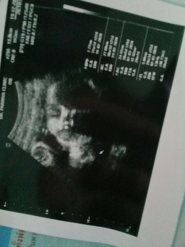 ลูกสาว