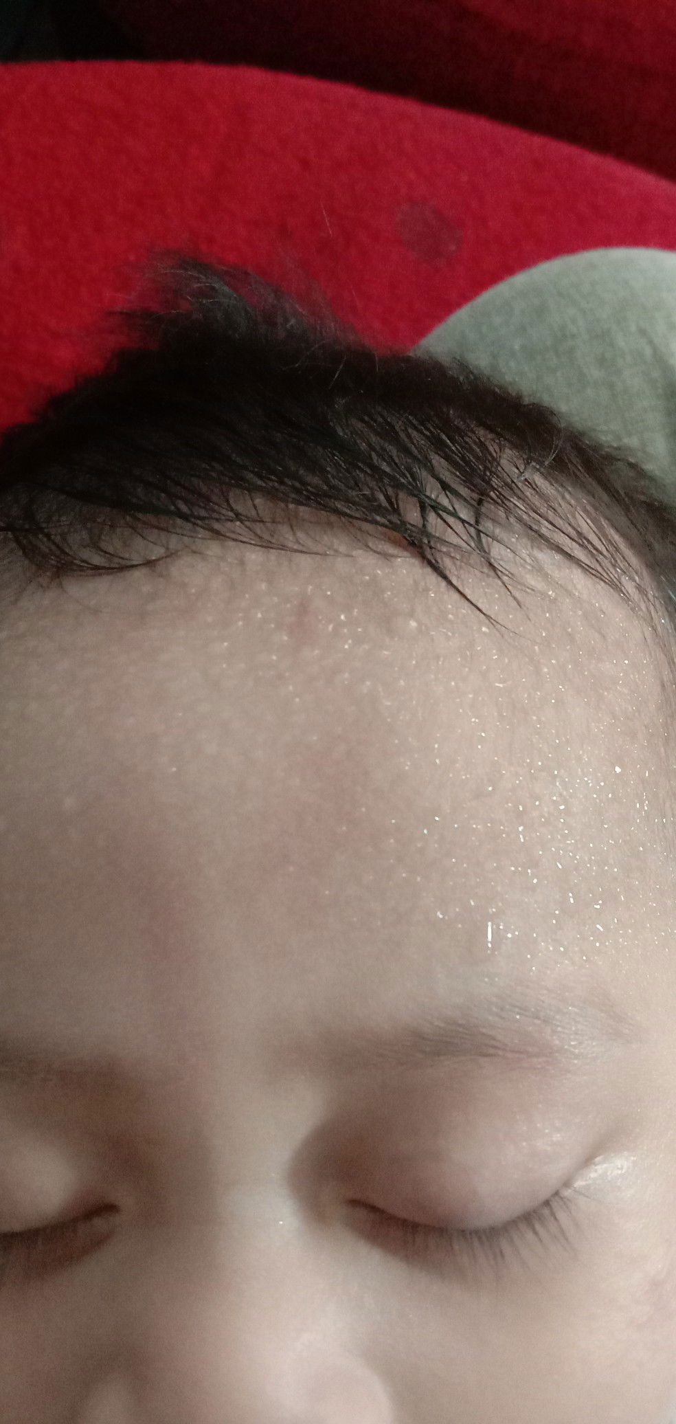 keringat di pening kpla