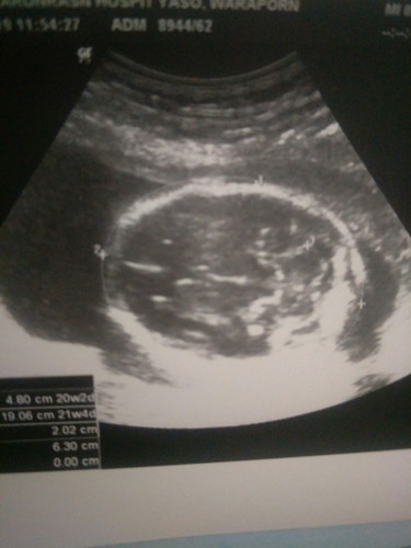 ถ่ายครั้งแรก