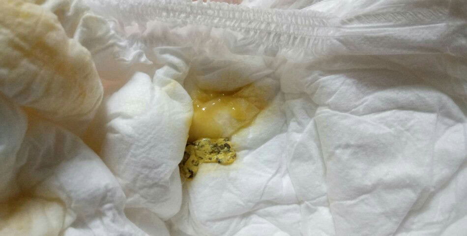 ปรึกษาค่ะ