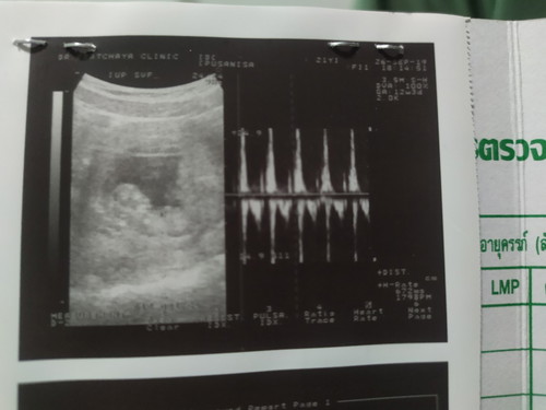 ฝากท้องครั้งแรก