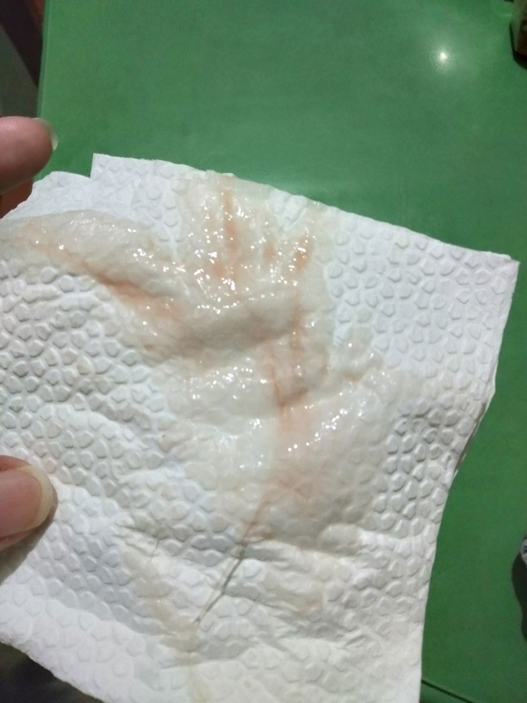 FTM . 38weeks and 5days pregnant