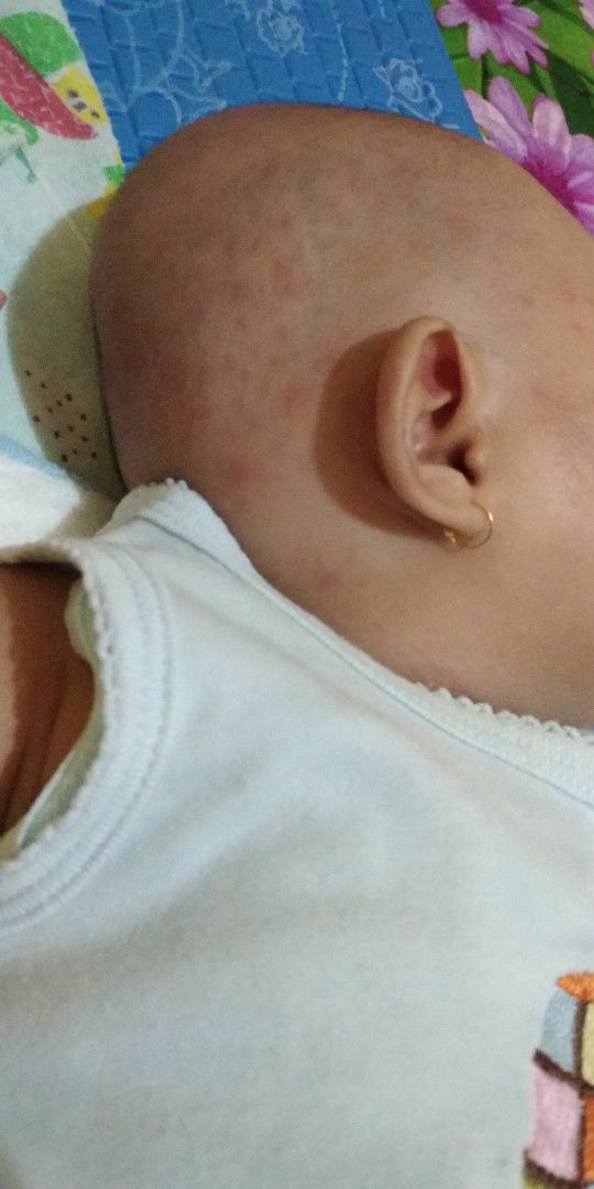 kepala pada bintik² merah