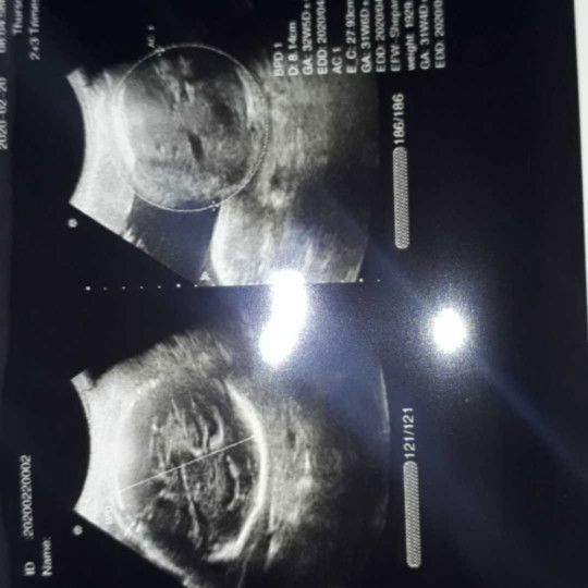 udah masuk panggul apa belum?