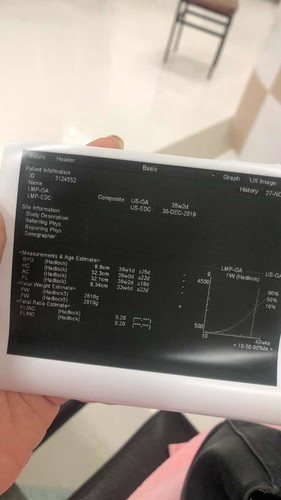 แม่ๆ 35 วีค ขาลูกยาวกี่เซนแล้วคะ