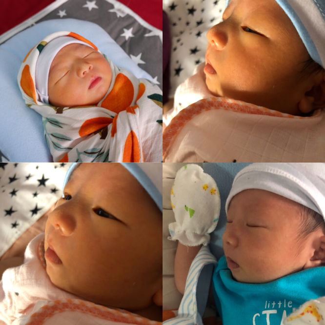 แบบนี้จมูกโด่งไหม