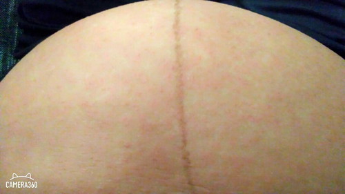 cetirizine???