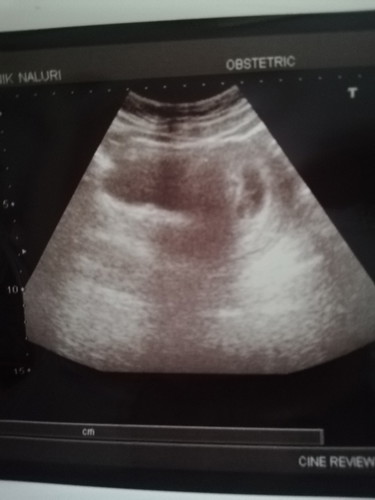 Nak tahu pengalaman