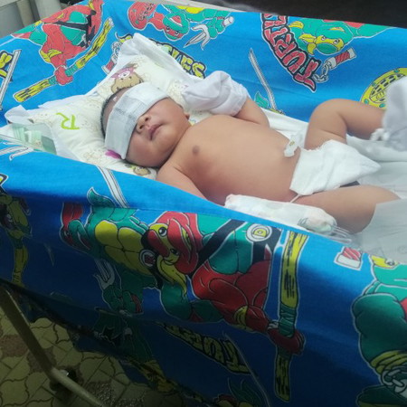 Paninilaw ng mata at katawan