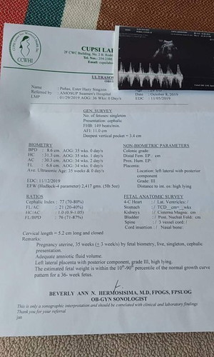 mga momshie malaki po buh baby ko??