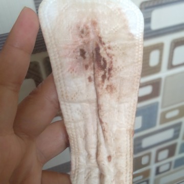 spotting pregnancy or menstruation?