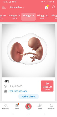 hplnya yg sama kyk saya siapa,