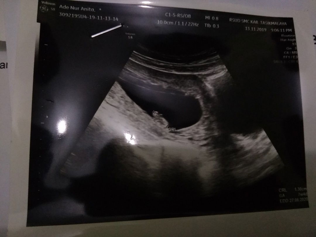 SELAMAT JALAN NAKK.. SAMPAI BERTEMU DI SURGA