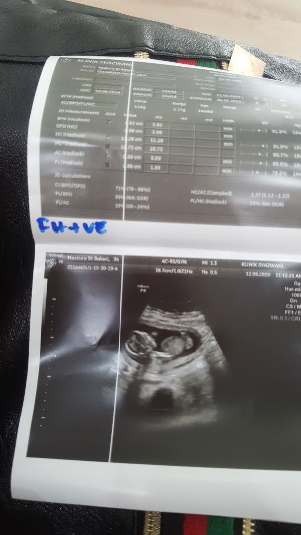 Pregnant 13weeks.. scan baby besar hampir 15weeks