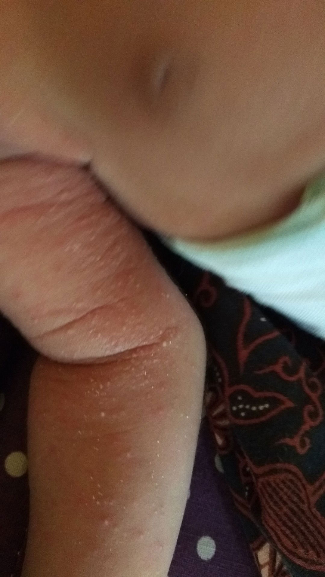 Kesehatan baby  new born