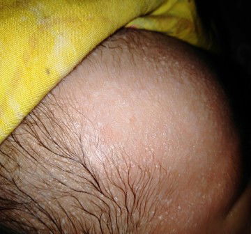 Bintik-bintik berair