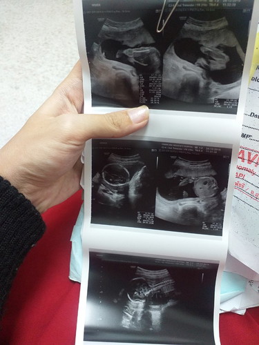 อยากได้ลูกสาว