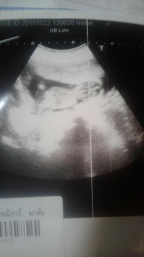 ❤ แม่รอหนู่อยู่นะลูก