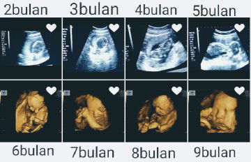 hpl 17 mei (38 week)