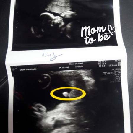 ได้ลูกชายจ้า 7เดือนแล้วค่ะ