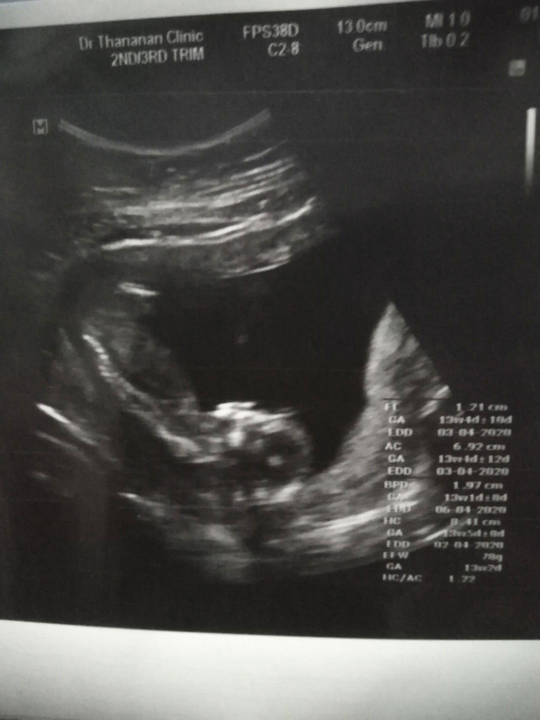 ไปหาหมอมาแล้วจ้า​ #ท้อง2จ้า