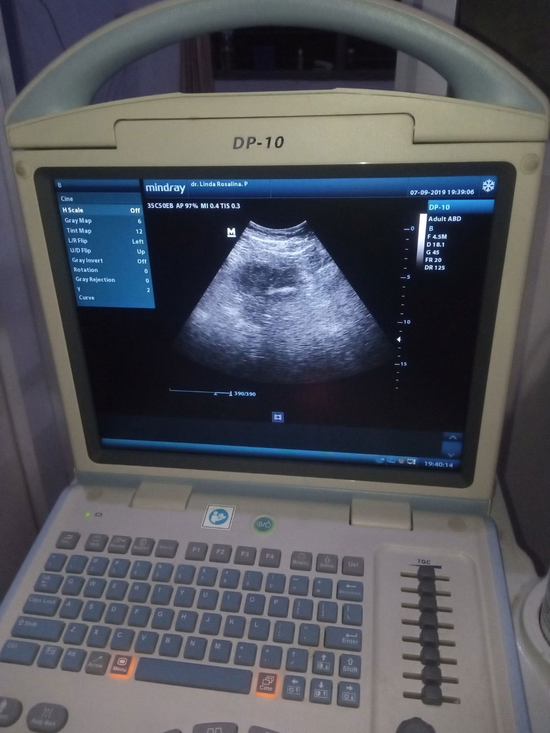 usg kurang penjelasan