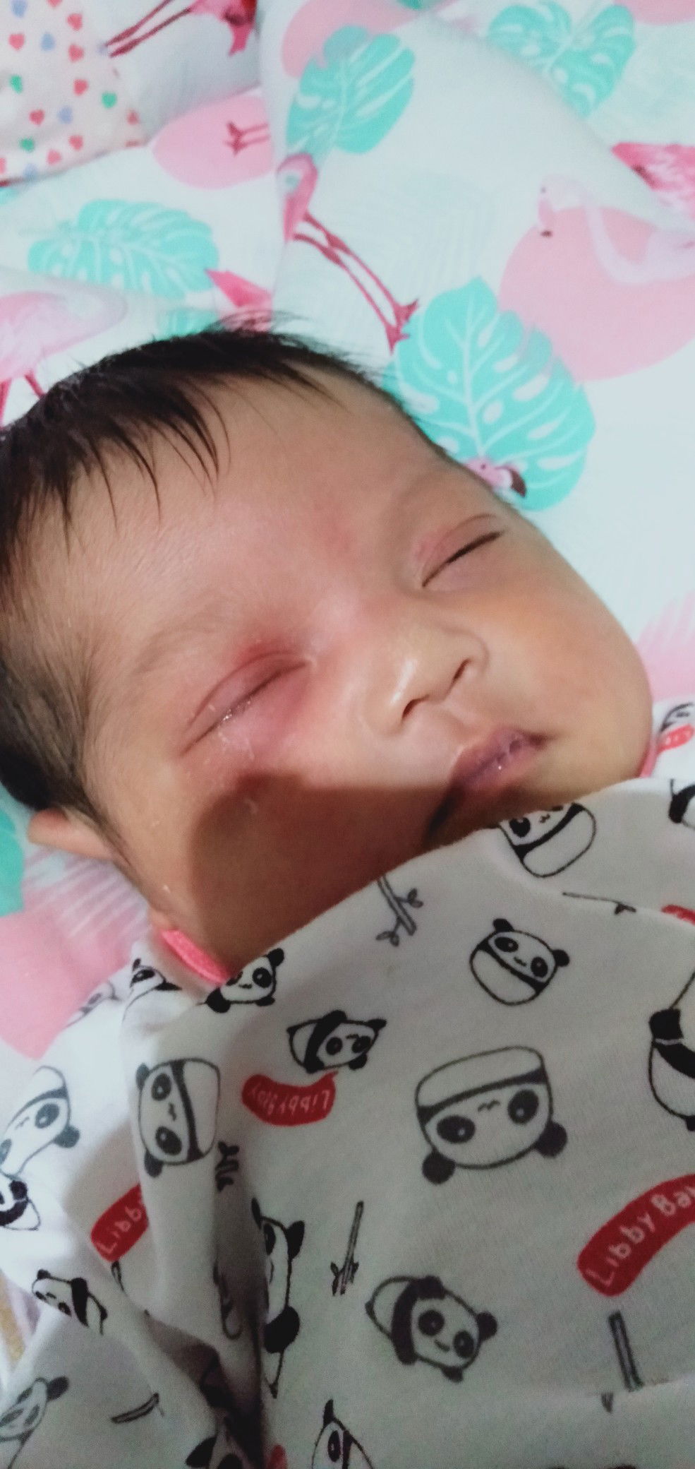 mata bayi belekan warna kuning