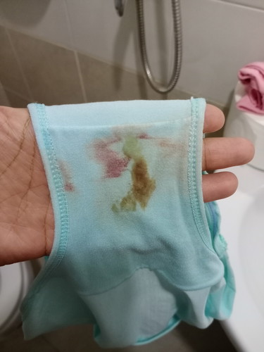 แม่ๆบ้านไหนเคยเจอแบบนี้บ้างค่ะ