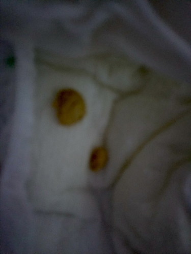 ทานไฮคิวซูเปอร์โกลด์พลัส