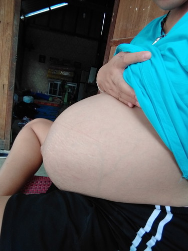 36+5w