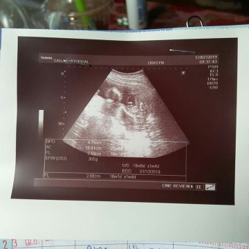เพศลูก
