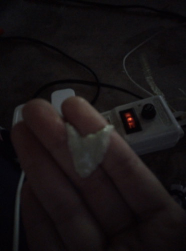 สีขาวๆเป็นก้อน