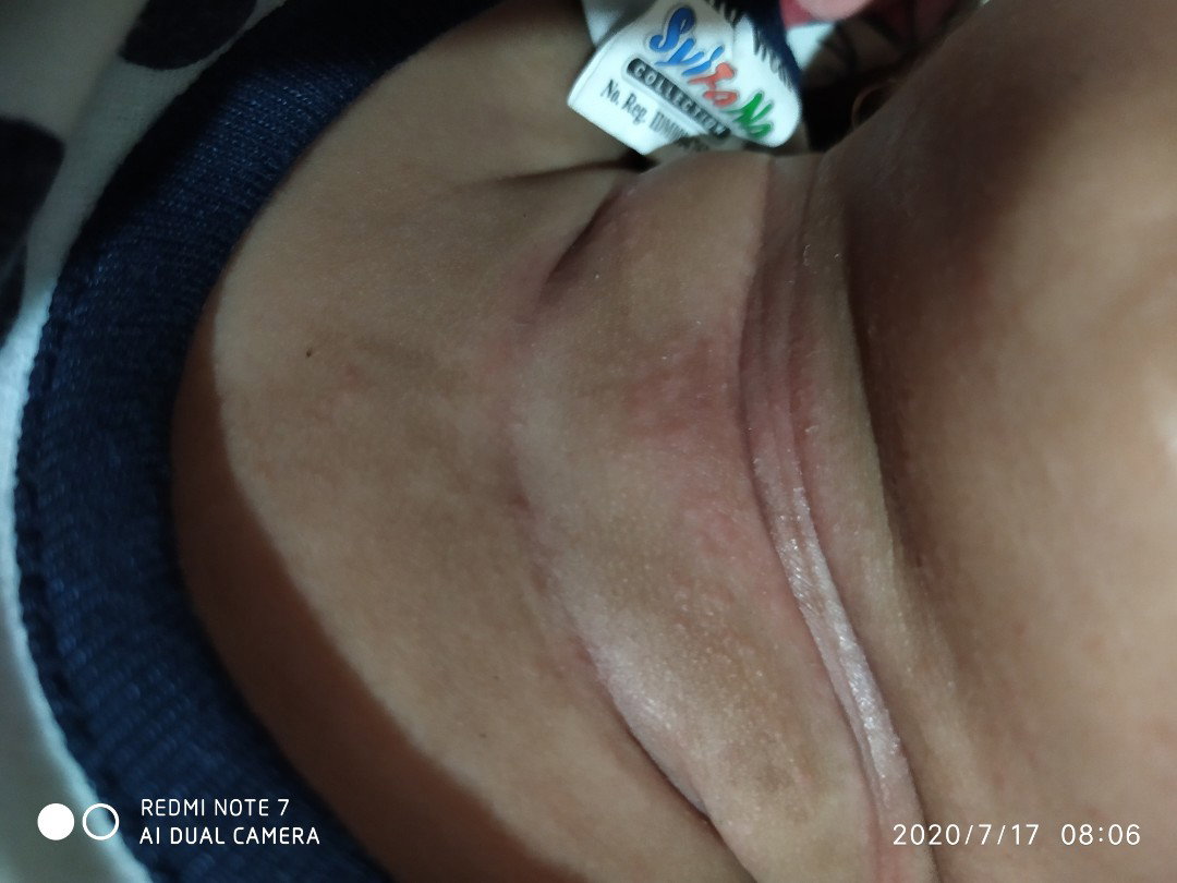 Bayi