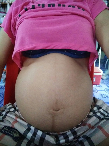 ขอดูแม่ๆ 9 เดือนหน่อย บ้านนี้36w1d