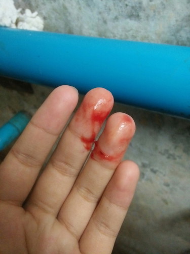 ไปหาหมอเลยมั้ยคะ