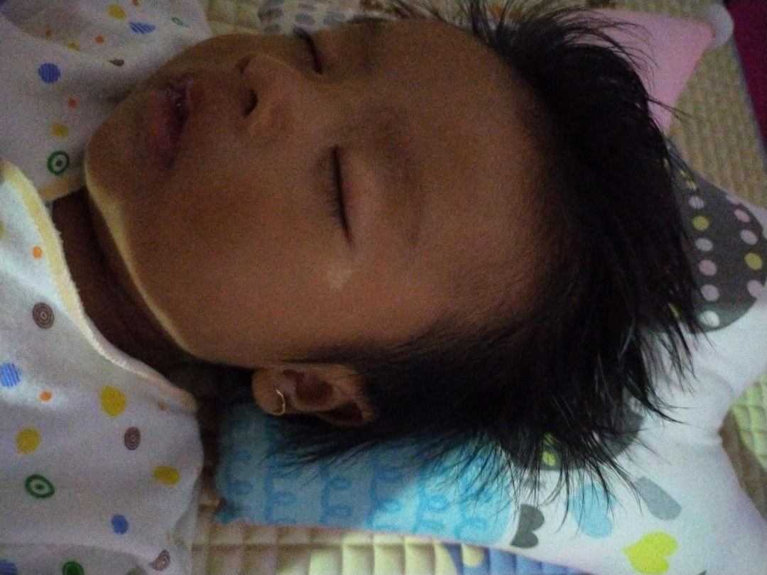 putih di wajah sebelah mata