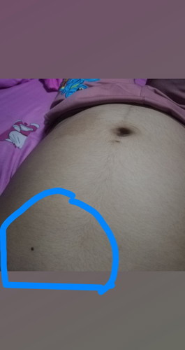 ปวดท้องจี้ดๆ
