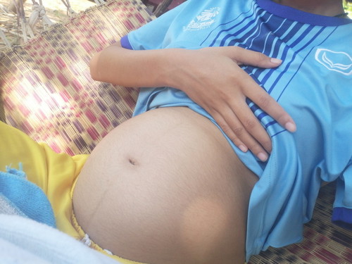 ตั้งครรภ์