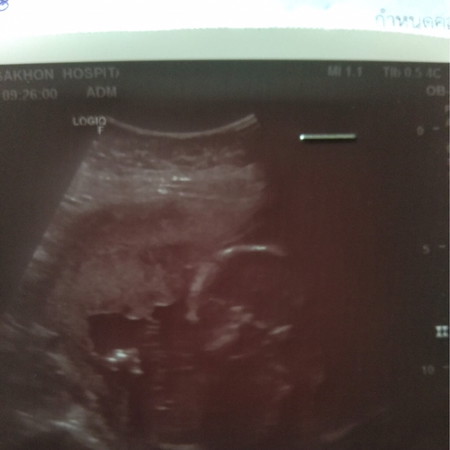 แม่คนไหนมีเซนการดูเพศลูกบ้างค่ะ