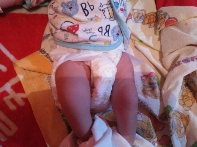 kaki bengkak sebelah