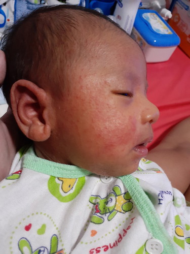 ลูกบ้านไหนเป็นแบบนี้บ้างค่ะ?