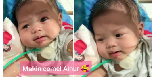Adik Ainul dah Tumbuh Gigi