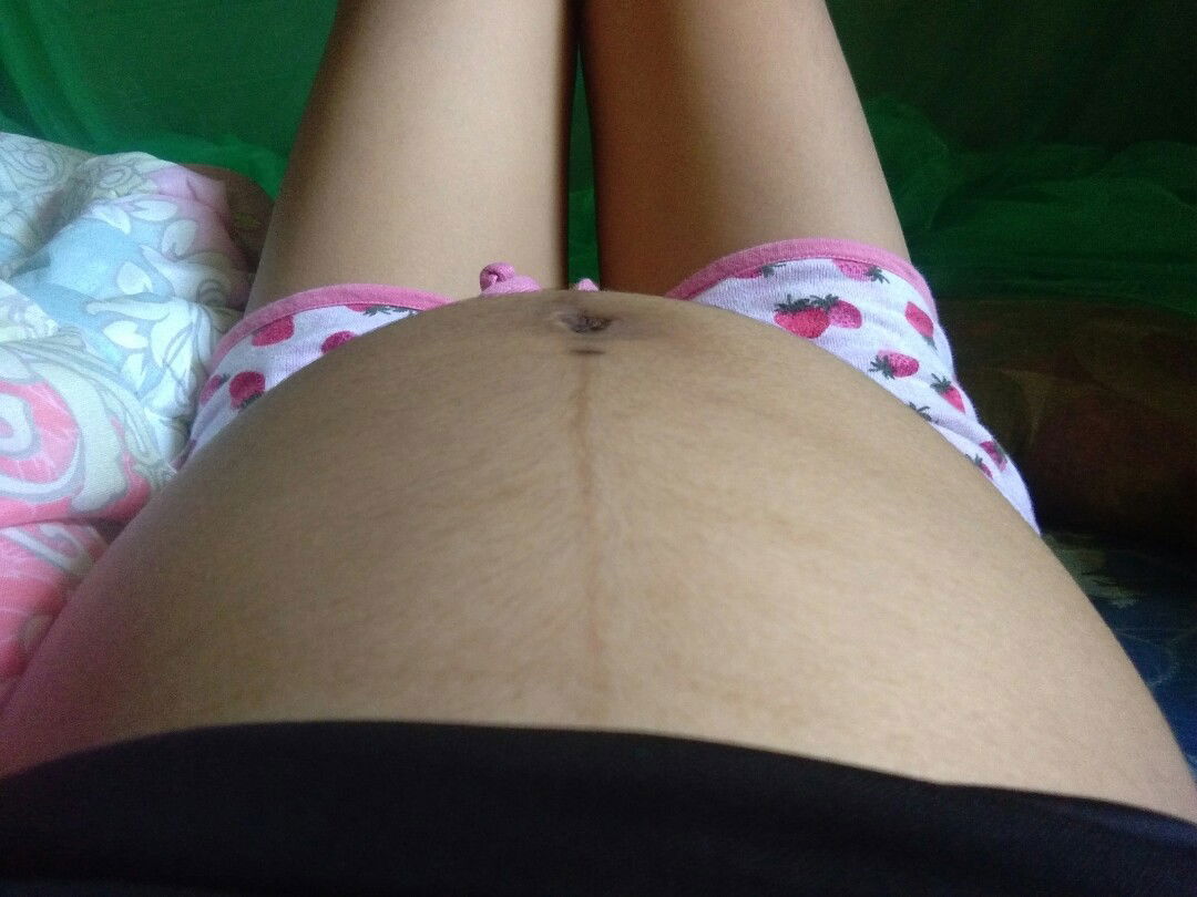 ท้อง 32 week ท้องเล็กมาก