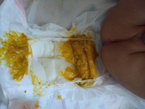 กังวลเรื่องอึของลูกวัย4เดือนค่ะ?