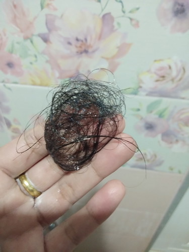 ผมร่วงหลังหลอด น่ากลัวมากค่ะ?!!
