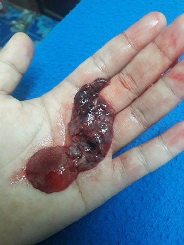 เเท้งหรือเปล่า